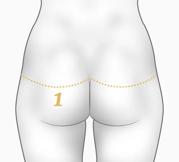 Illustration bodylift dos - cicatrices