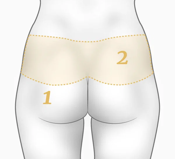 Illustration bodylift dos - principe