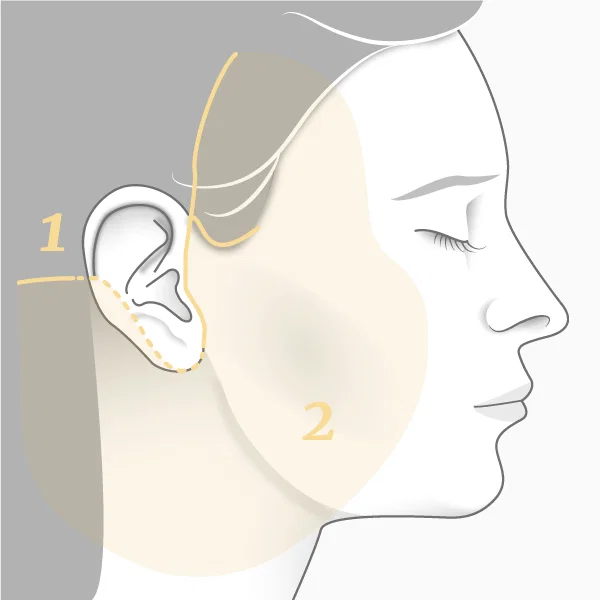 illustration Lifting cervico-facial principe
