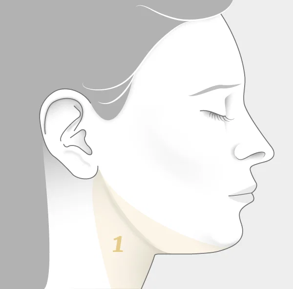 Illustration liposuccion du cou